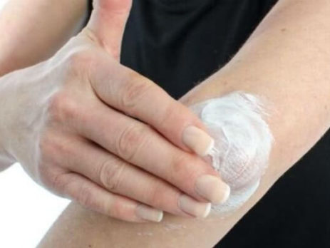 Фото: нанесение противовоспалительной мази